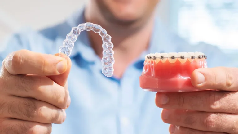 Hands holding a clear dental aligner beside an orthodontic model with metal braces.