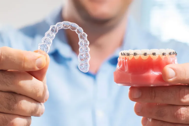 Hands holding a clear dental aligner beside an orthodontic model with metal braces.